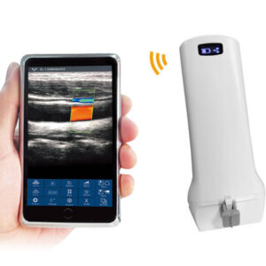VISION6 L/P Linear Palm Doppler Ultrasound Scanner: Technical Specifications
