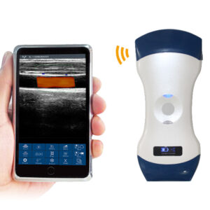VISION5 CL 2in1 Palm Doppler Ultrasound Scanner