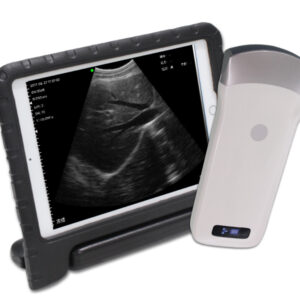 VISION3 C  convex palm B/W ultrasound scanner