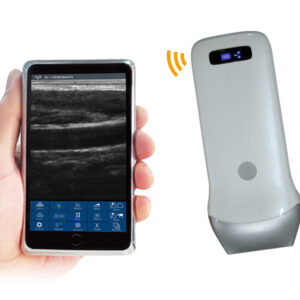 VISION3 L  linear palm B/W ultrasound scanner