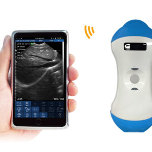 VISION5 MN 2in1 Palm Doppler Ultrasound Scanner