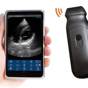 VISION6 6PA Phased Array Palm Doppler Ultrasound Scanner