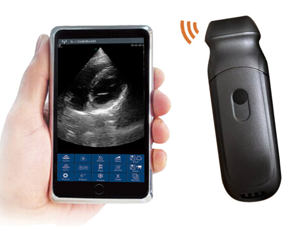 VISION6 6PA Phased Array Palm Doppler Ultrasound Scanner - SONOSTAR GROUP