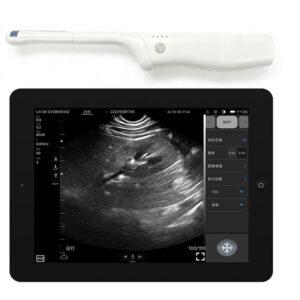 VISION8 CR biplane rectal palm doppler ultrasound scanner