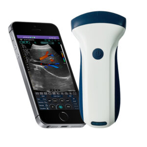 VISION7 C convex palm doppler ultrasound scanner