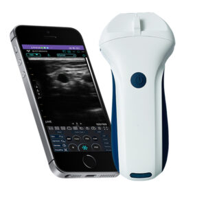 VISION7 P Linear Palm Doppler Ultrasound Scanner