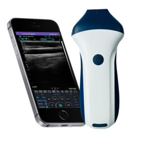 VISION7 H linear palm doppler ultrasound scanner