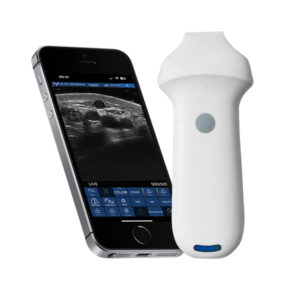 VISION8 S linear palm doppler ultrasound scanner
