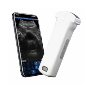 VISION6 C Convex Palm Doppler Ultrasound Scanner