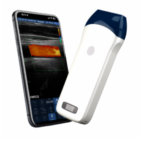 VISION5 L Linear Palm Doppler Ultrasound Scanner