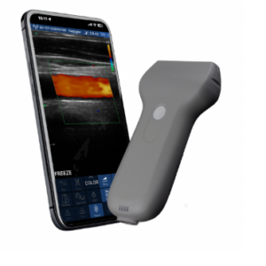 VISION4 L Linear Palm Doppler Ultrasound Scanner