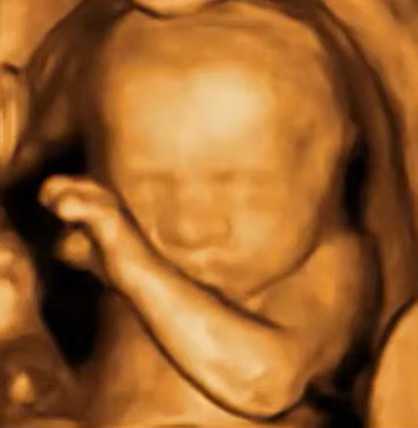 SONOSTARGROUP 3D Probe