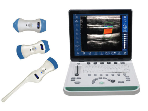 Up Robe Sonostar UProbe Portable Wireless Ultrasound Diagnostic System with wireless ...